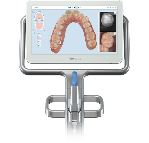 Dental imaging device with screen displaying a detailed 3D model of upper teeth and close-up images of individual teeth for analysis.