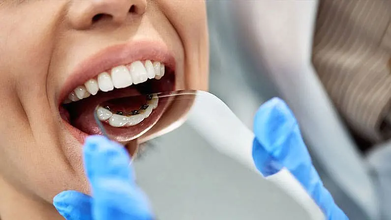 A person with their mouth open is having a dental check-up. A blue-gloved hand holds a dental mirror to examine the teeth, inspecting the adult braces that ensure everything aligns perfectly in NYC