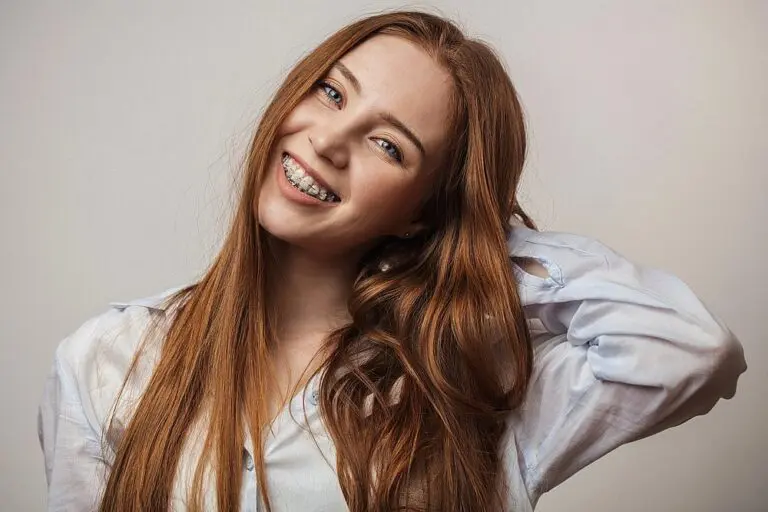 Young woman smiling confidently with long hair – braces for overbite in New York, NY.