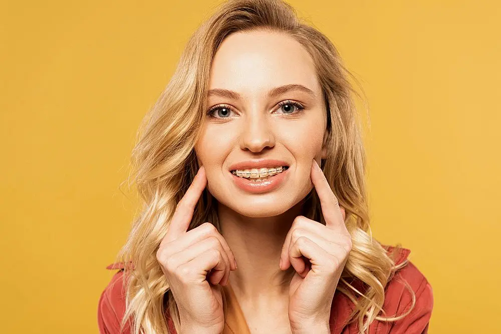 smiling blonde woman clear braces looking camera isolated yellow - Overbite vs Underbite in New York, NY