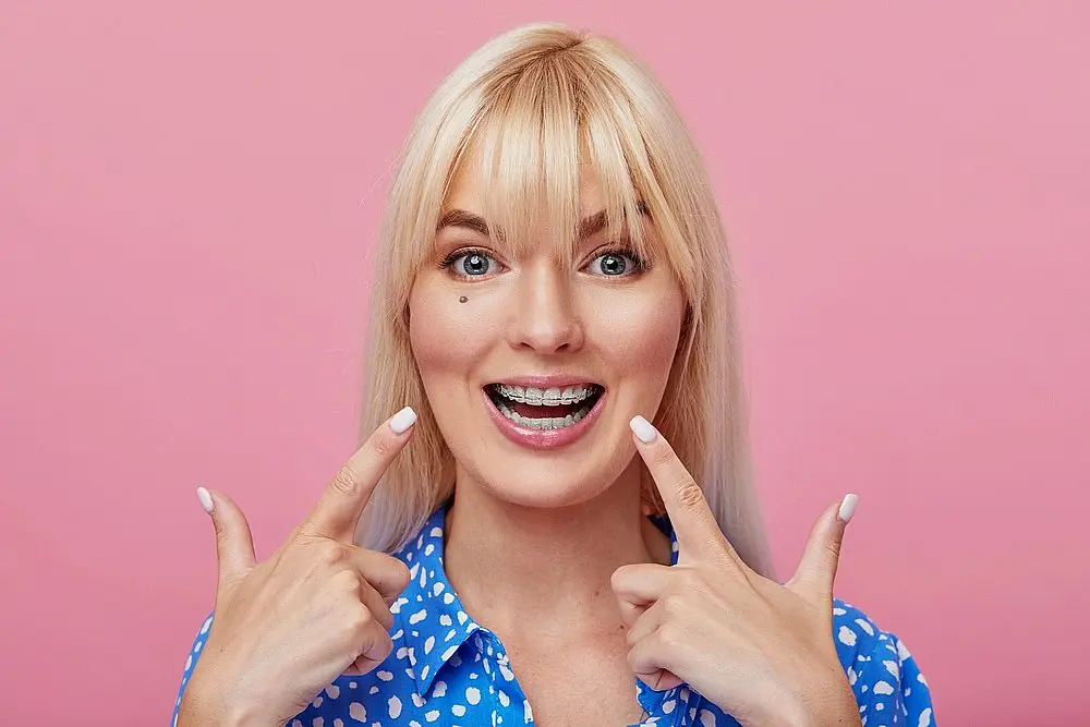 cheerful happy young woman blonde hair gesturing thumb while pointing clear braces - Clear Braces vs Metal Braces in New York CIty, NY