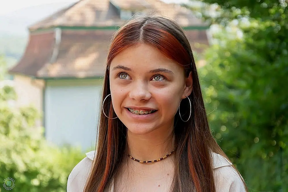 beautiful teenage girl metal braces smiles street - How to Clean Braces in New York City, NY