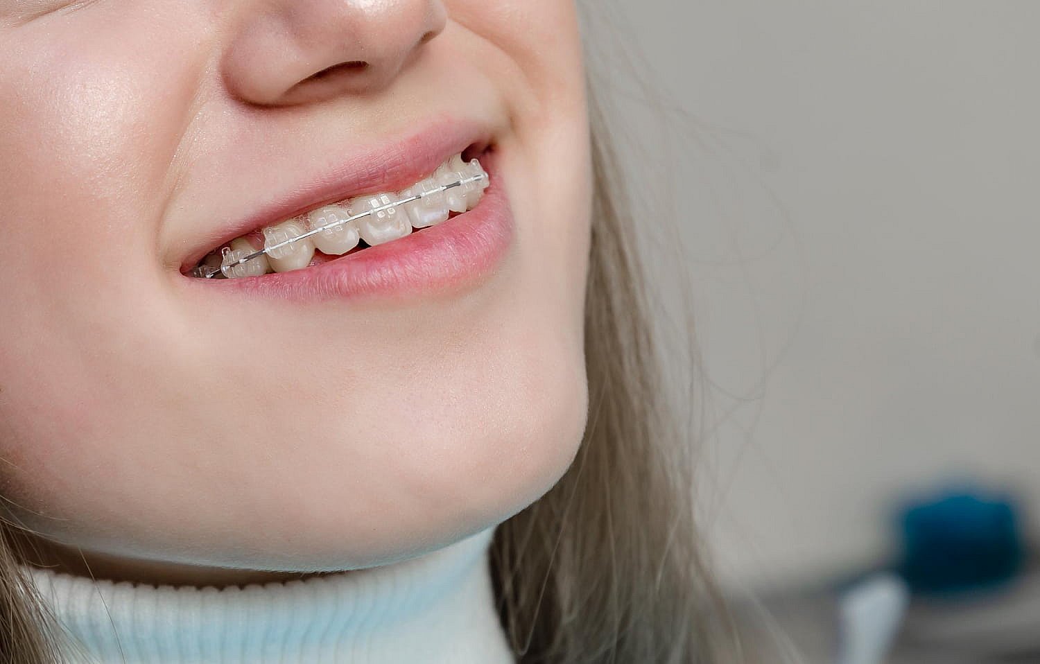 A close-up captures a radiant smile framed by clear braces, subtly blending with the teeth. The blurred background highlights the beauty and confidence of a straightened smile in NYC