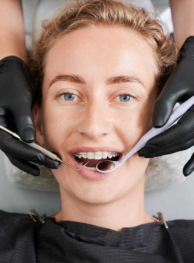 Person receiving a dental check-up, wearing ceramic braces, while the dentist holds instruments like a mirror and scaler in a clinical setting in NYC