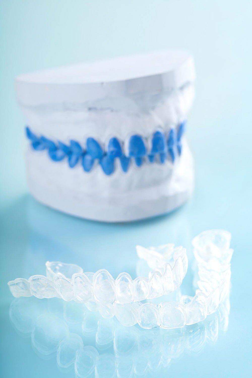 Clear dental aligners rest in front of a dental model with striking blue teeth against a serene light blue background, showcasing how Invisalign's payment plan makes achieving a perfect smile more accessible in NYC