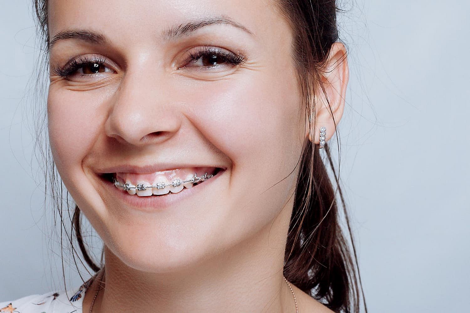 A woman with long dark hair smiles, revealing metal braces designed to correct her overbite. She's wearing small earrings that add a touch of elegance to her cheerful appearance in NYC