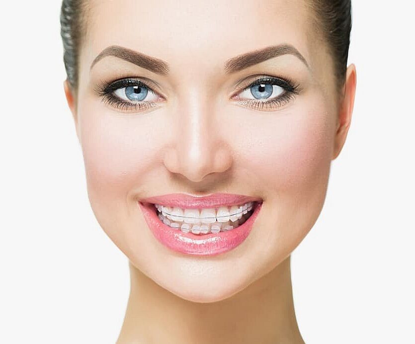 Best Orthodontics A woman smiles brightly, her clear braces subtly enhancing her teeth against a pristine white background in NYC
