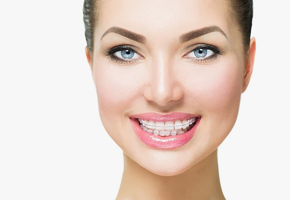 A woman smiles brightly, her clear braces subtly enhancing her teeth against a pristine white background in NYC