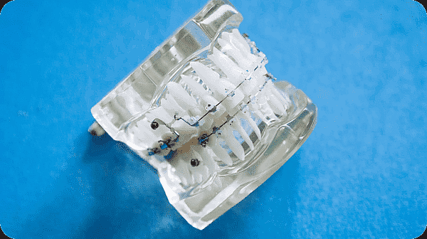 A clear dental model showcasing metal braces on teeth, set against a serene blue background in NYC